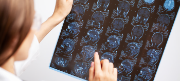 Neurological Conditions